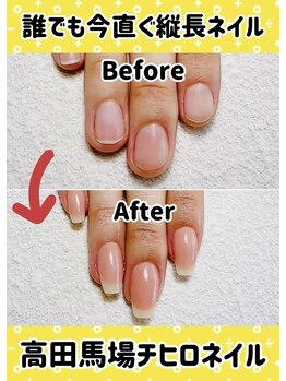 チヒロネイル/縦長ネイルベットスカルプ