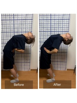 幸鍼灸整体院 武庫之荘院/整体・トレーニング・姿勢変化21