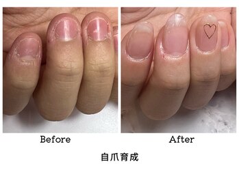 アンベリール(embellir.)/自爪育成コース