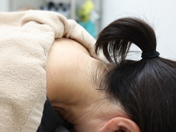 サンライズ鍼灸整骨院 豊中本院/一人一人に合わせた鍼施術