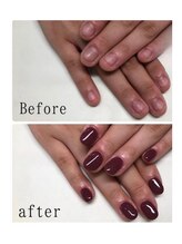 ティアラネイル 宇都宮/深爪矯正