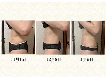 カピリナ(Kapilina)/ 1ヶ月通い放題【40代後半女性】