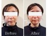 【小顔も全身痩せも叶えたい】痩せるだけじゃない!小顔美肌フェイシャル付き