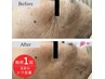 結果重視の最新美容液＆機器でシミ・シワ・肌質改善フェイシャル90分
