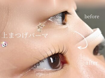 リノア(Linoa)/上がりにくい方もお任せください