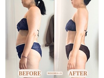 マクイエステティック 表参道店の写真/【食事制限・運動ゼロで本当に変わった】40~60代むくみ専門／1回でウエスト-5cm実感／表参道の痩身エステ