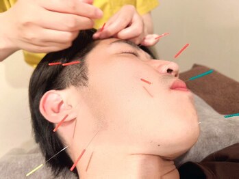 トランク鍼灸院 整骨院 大宮(TRUNK鍼灸院 整骨院)/男性も歓迎！美容鍼/美顔鍼♪