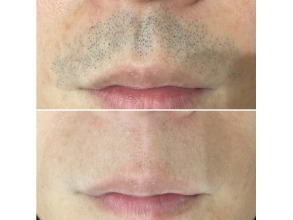 ルーリオ(Luglio)の写真