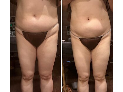 神楽坂のほぐし堂の写真