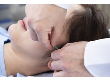 青南針療所 表参道院の雰囲気（刺さない低リスクの美容鍼でハリ、ツヤが向上。むくみの解消に！）