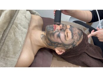 アール(R)/【 オキシバブルピーリング 】