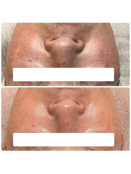 ボディメイキング キキ(Bodymaking KIKI)/くすみ・たるみ・乾燥に◎