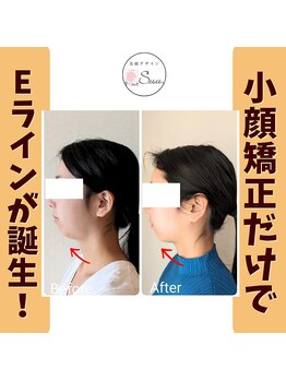 美顔デザインsuu.~若見えと歪み矯正専門の小顔サロン~/Before-After【30代】12 回