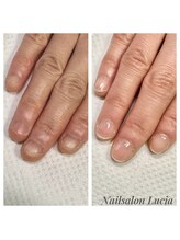 ネイルサロンルキア(Nail salon Lucia)/【手の深爪】クリアジェル保護