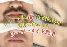 アルゴ 金沢増泉店(ALGO)