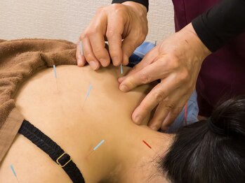 いなほ はりきゅう整骨院 東新宿の写真/肩こり・関節のお悩み・身体の違和感【東新宿☆いなほ鍼灸整骨院】お仕事やスポーツ等で傷んだ身体もお任せ