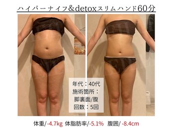 メイリー(MEILLI)/慢性的なぽっこりお腹に
