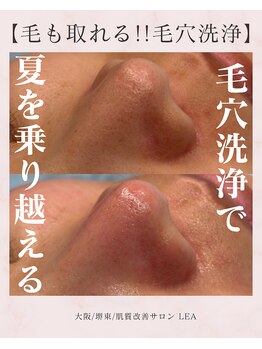 レア(Lea)/詰まりやすい夏を乗り越える！