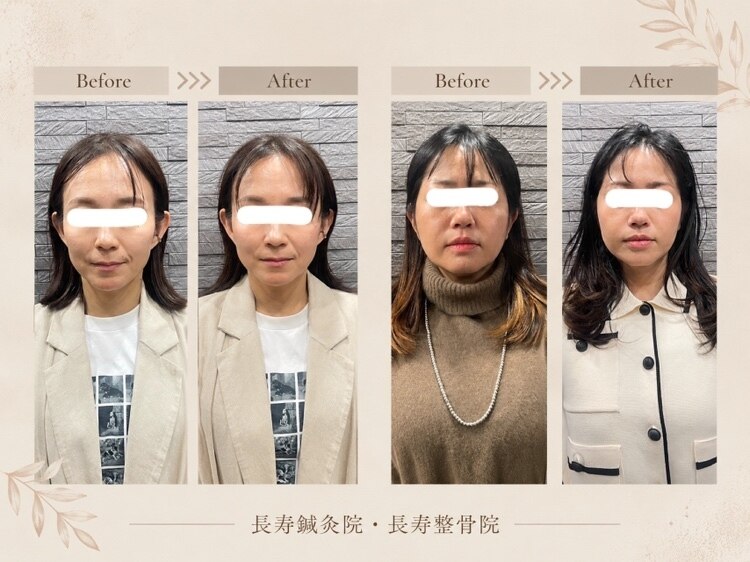 滋賀県でEMSが人気のエステサロン｜ホットペッパービューティー