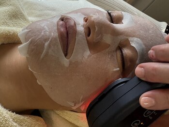 ナル(Nalu.)の写真/幹細胞ダーマ鍼で叶える、しわたるみの改善!最高峰のエイジングケア◎