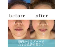 バリスパ ラヒル(Bali Spa Lahir)の雰囲気（お顔のたるみ・むくみ・リフトアップケア☆）