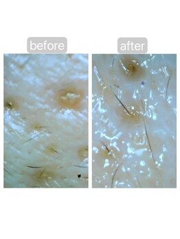 トランク(Trunk)/ハイドラ♪before→after