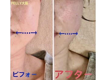 ペリー(PELLY)/身体全身スッキリ?