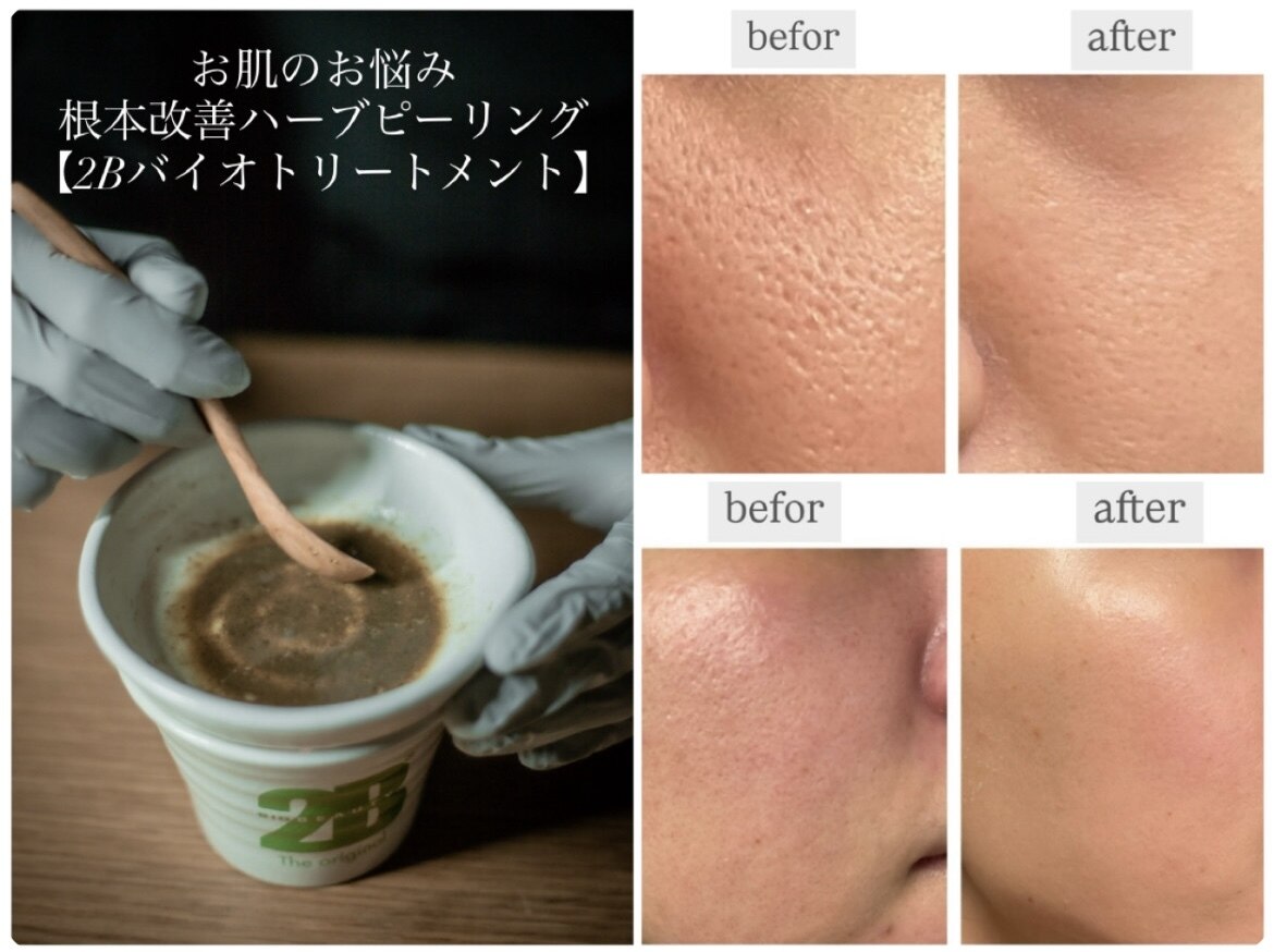 熊本市中央区で美肌が人気のエステサロン｜ホットペッパービューティー