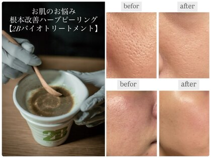 シャムリー 並木坂(Syamry)の写真