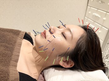 クマノミ美容鍼灸 銀座院(KUMANOMI美容鍼灸)/眼精疲労や自律神経の整えにも◎
