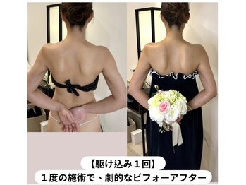 蒼(so)/他の整体や機器では解決できない