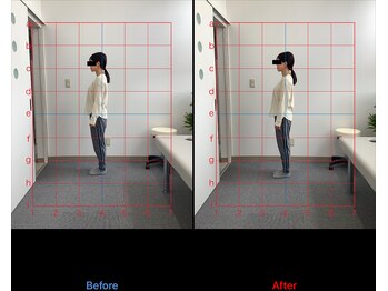 リード整骨院(LEAD整骨院)/姿勢改善、猫背、反り腰