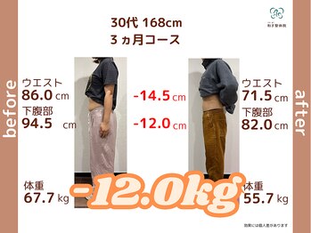 和ぎ整体院の写真/隠す服より着たい服のために!骨盤も肋骨の整えて弱った筋肉も回復
きつい運動なしで無理なく痩せられる♪