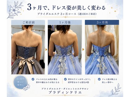 プラディンケリエの写真
