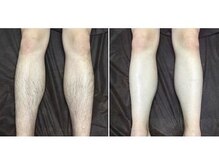 メンズ シンバ(SIMBA)/☆ ビフォーアフター ☆