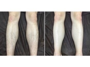 メンズ シンバ(SIMBA)/☆ ビフォーアフター ☆