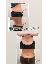 デスティン(Destin)/キャビテーションの約5倍！