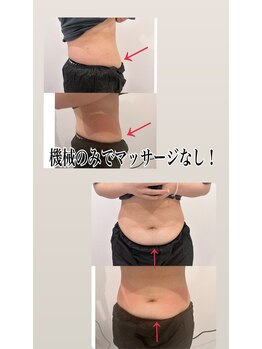 デスティン(Destin)/キャビテーションの約5倍！