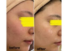 マスカレード 品川(Masquerade)/【クリスティーナ症例写真】