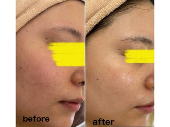 マスカレード 品川(Masquerade)/【クリスティーナ症例写真】