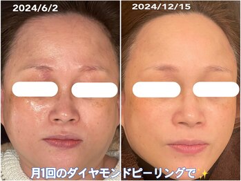 スイッチ(SWITCH!)/月1回のご褒美ケア