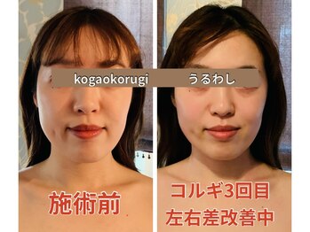 ウルワシ(Uruwashi)/★ビフォーアフター★