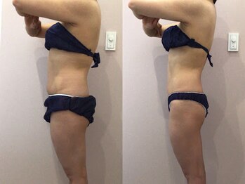 ビラ 銀座店(BILA)/キャビラジ