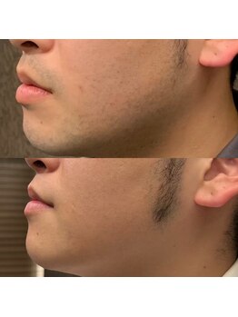 フェリーバ 浦和店(FELIVA)/Before&After