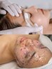 美眉WAX+水光艶肌フルフェイシャルWAX +ハイドロジェリーマスク全顔付