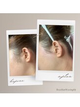 ブラジリアンワキシング シックスナイン(BrazilianWaxing69)/女性 / もみあげ