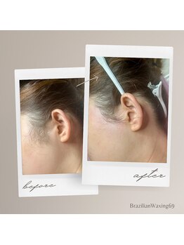 ブラジリアンワキシング シックスナイン(BrazilianWaxing69)/女性 / もみあげ
