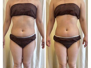 ペルラペティーユ(PERLA PETILLER)/お腹