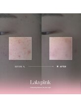 カルム(Calme)/Lalapink