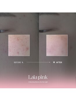 カルム(Calme)/Lalapink